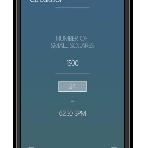 Review: Analyze ECG&nbsp;Reporting
