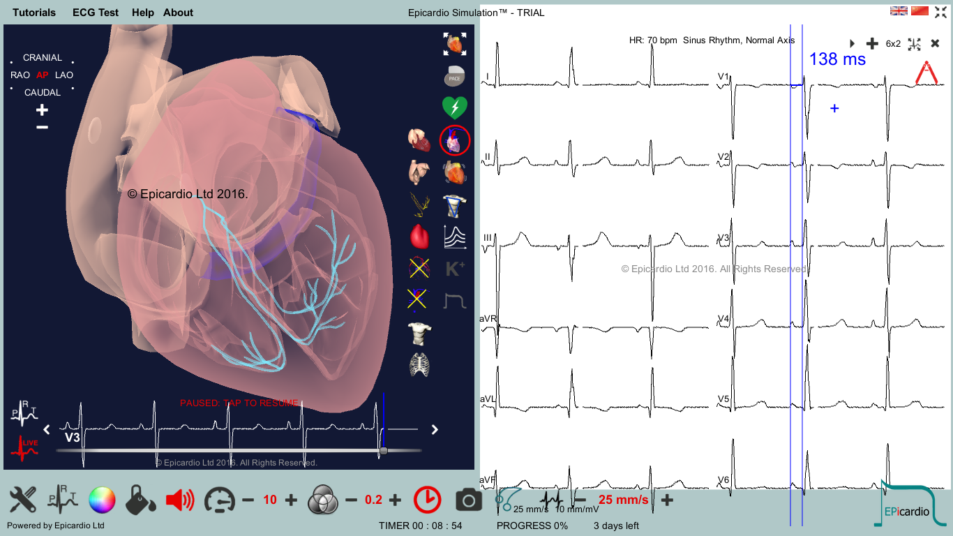 Review: Epicardio Simulation v1.5 (Trial) – The Student Physiologist