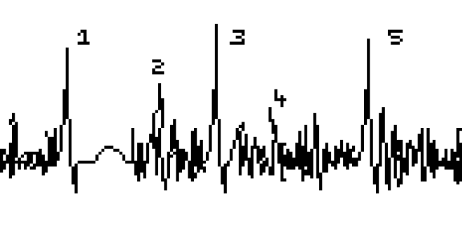 temporary_1471219665199 (2)