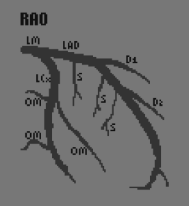 Anatomic Heart Rao Angiographic Views – The Student Physiologist